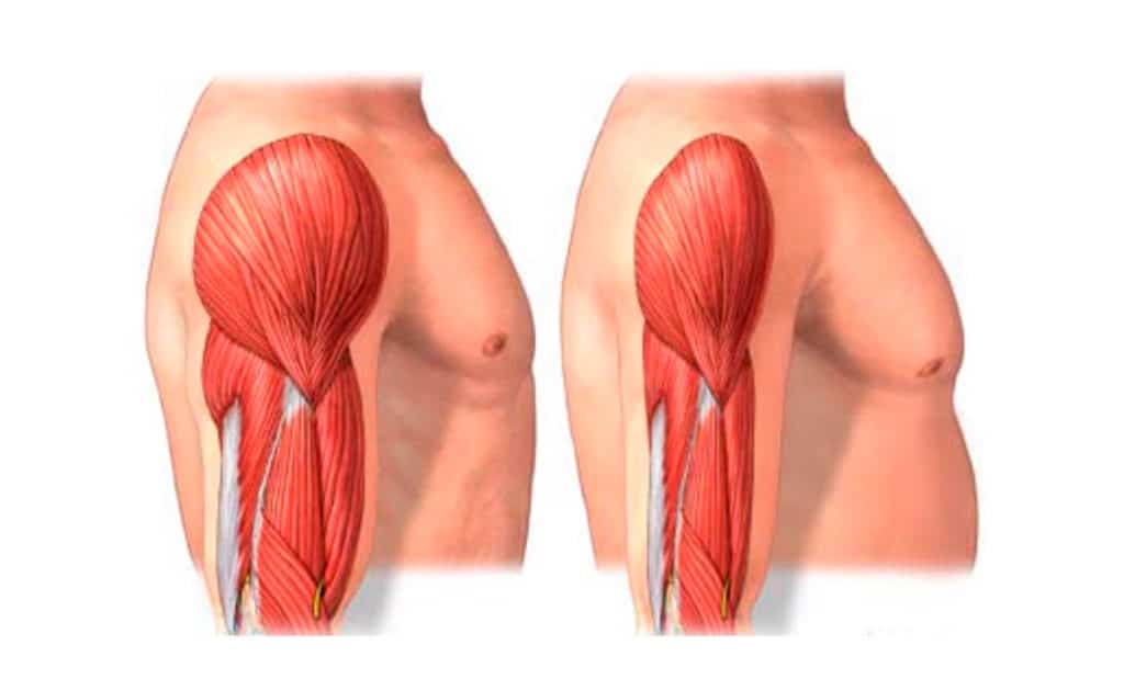 Qué enfermedades causan pérdida de masa muscular - Fit Soul